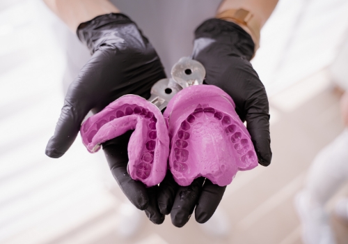 Gloved hands holding dental impressions for oral appliance