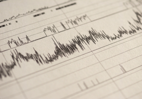 Close up of heart rate test results on paper